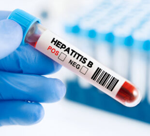 Hepatitas B