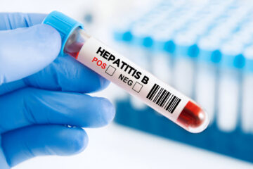 Hepatitas B