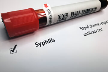 Sifilis