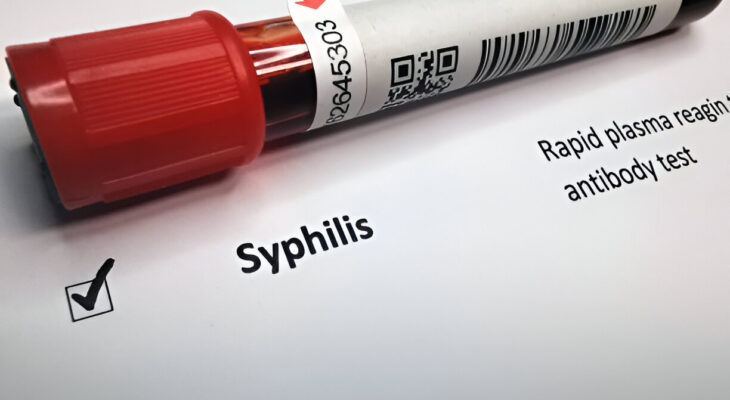 Sifilis