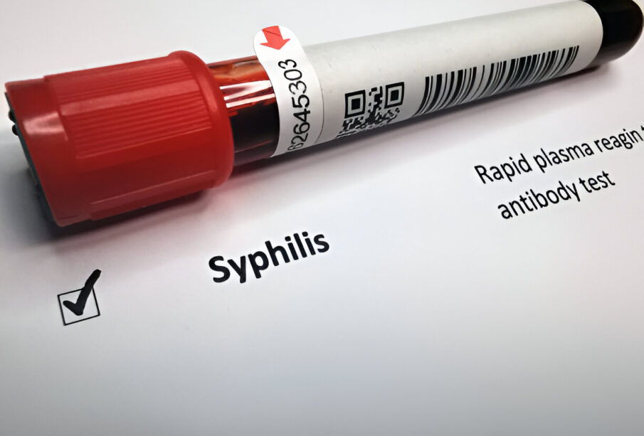 Sifilis