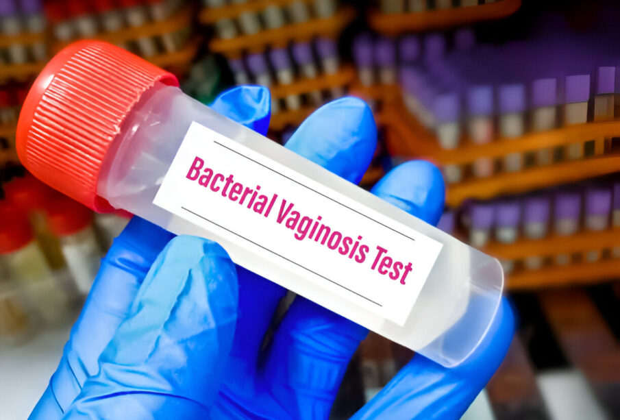 Bakterinė vaginozė