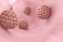 Žmogaus papilomos virusas