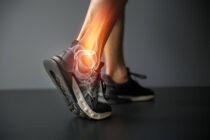 Kulkšnies skausmas po vaikščiojimo