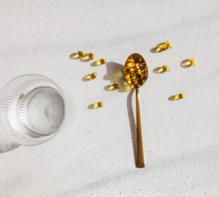 Vitamino D trūkumas