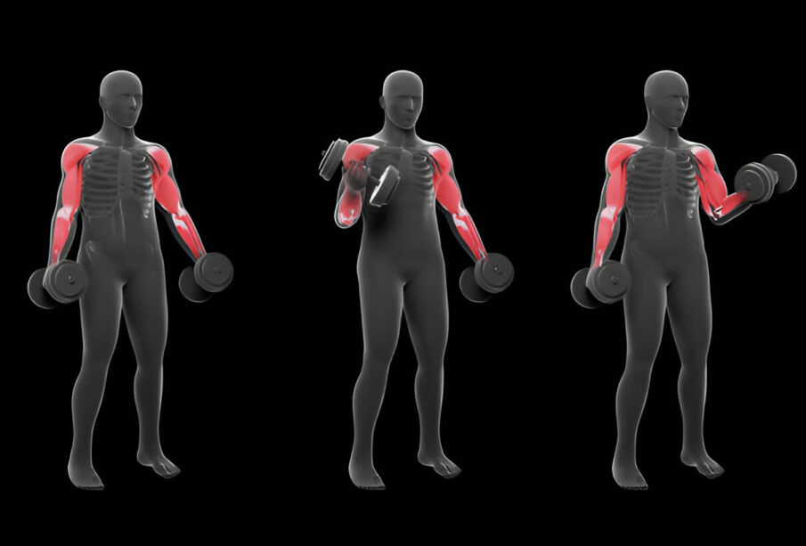 Raumenų tonuso sutrikimai