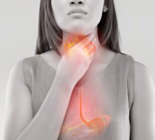 Rūgšties refliuksas