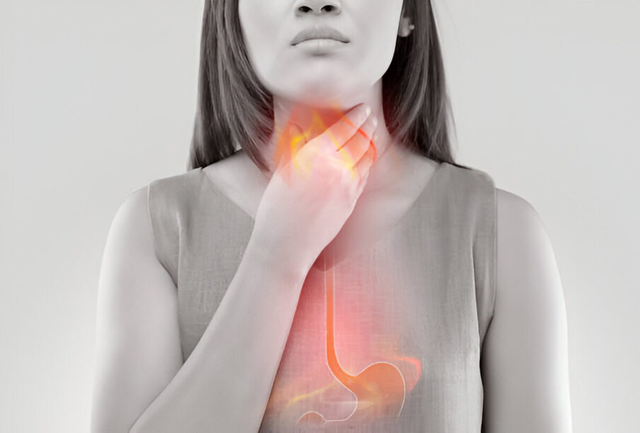 Rūgšties refliuksas