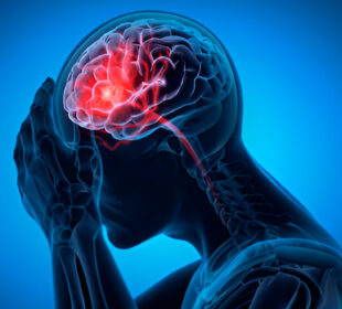 Sensoriumo pokyčiai