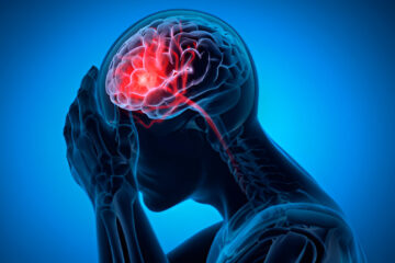 Sensoriumo pokyčiai