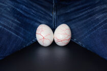 Testikulinė atrofija: