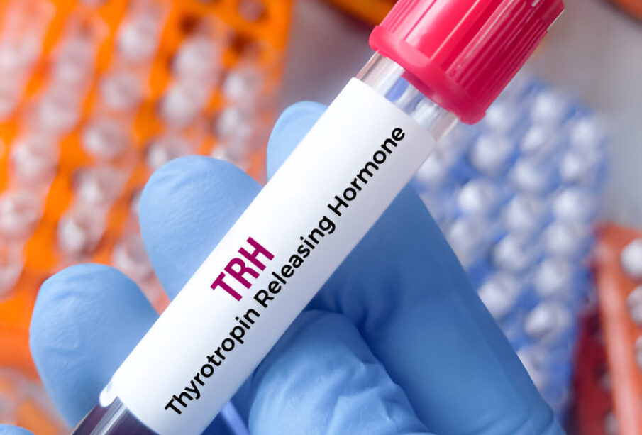 tirotropinas
