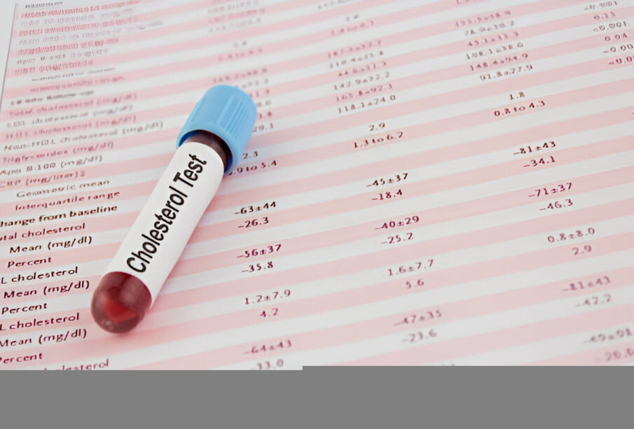 Cholesterolio tyrimas