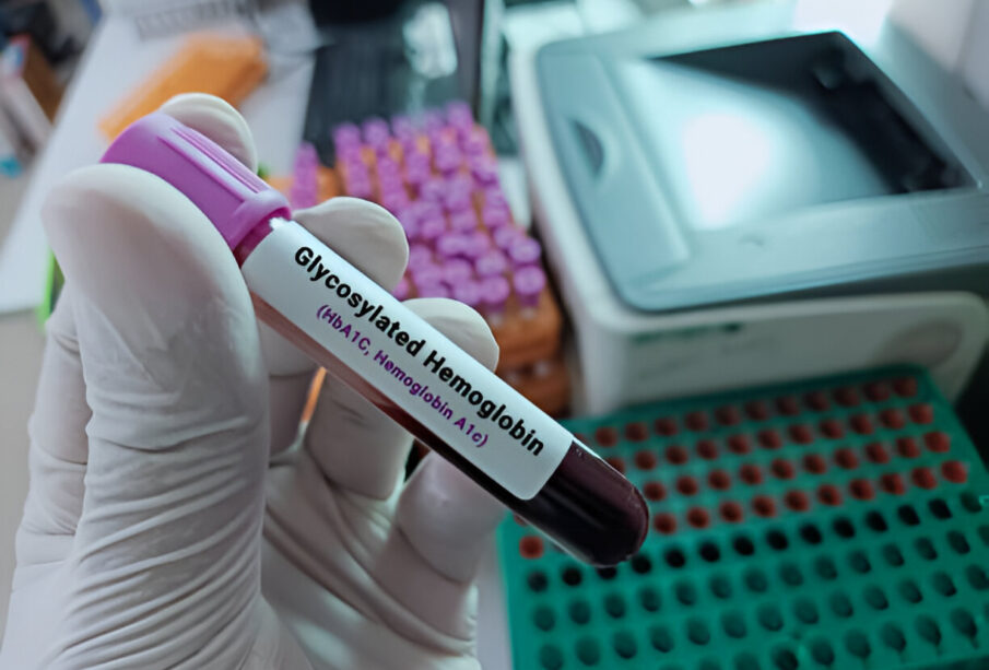 Glikozilinto hemoglobino testo svarba ir procedūra diabeto kontrolei
