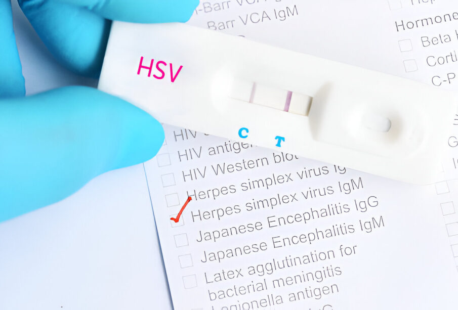 Herpeso testas