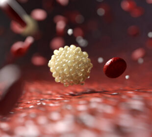 Kaip mankšta mažina trigliceridų kiekį – ir kodėl tai taip svarbu