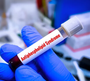 Kardiolipino antikūnų testas