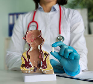 Proktologiniai tyrimai