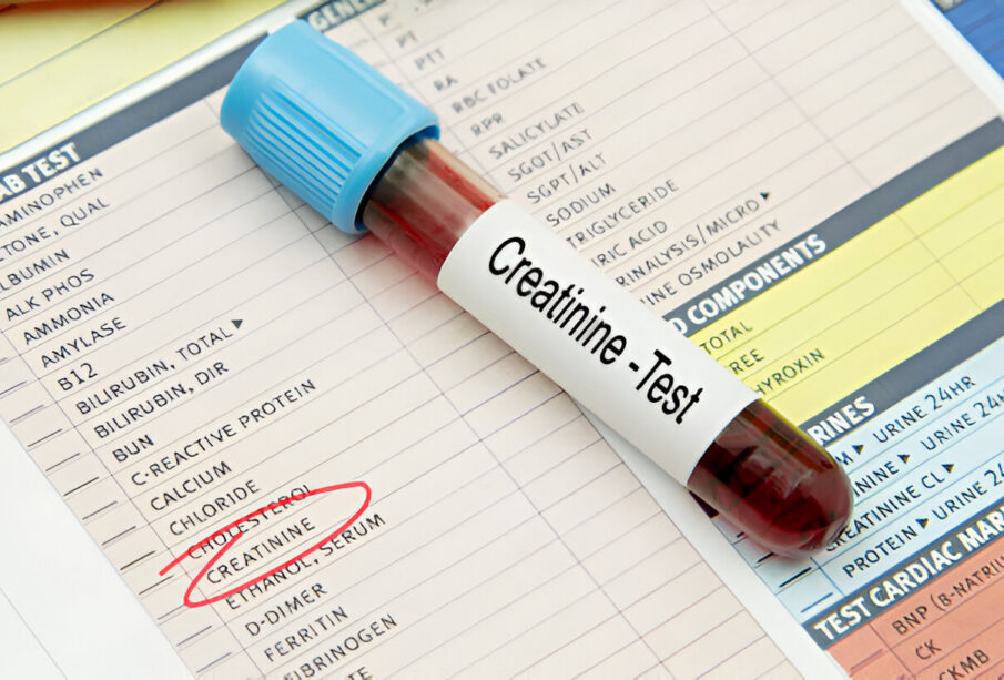Serumo kreatinino tyrimas