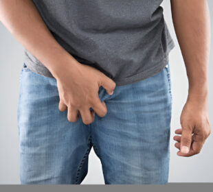 Vyriška mielių infekcija