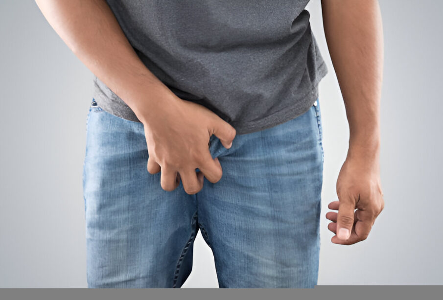 Vyriška mielių infekcija