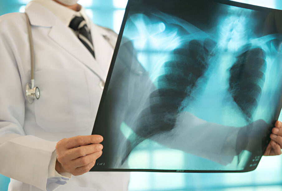 Žalingi įpročiai tuberkuliozės spąstuose